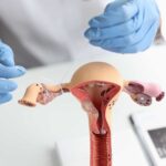 Exploring the Surge in Women's Sterilization Choices Post-2016 Election