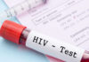 Breakthrough Approach to Revolutionizing HIV Prevention Unveiled