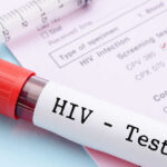 Breakthrough Approach to Revolutionizing HIV Prevention Unveiled