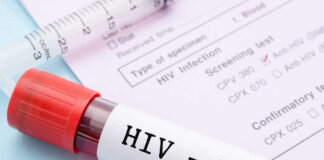 Breakthrough Approach to Revolutionizing HIV Prevention Unveiled